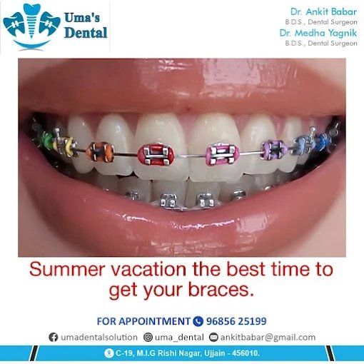 Orthodontic Ceramic & Colorful Braces